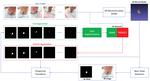 Multi-View Data Augmentation to Improve Wound Segmentation on 3D Surface Model by Deep Learning