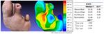 Combined thermal and color 3D model for wound evaluation from handheld devices